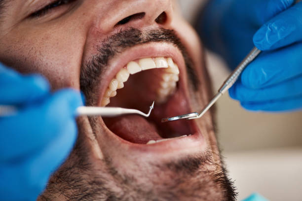 Professional Holistic Dental Care Services in North Sea, NY